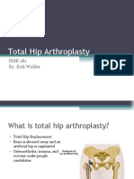 Total Hip Arthroplasty: BME 181 By: Erik Walder