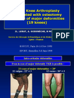 TKA + Osteotomy