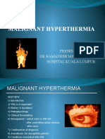 Malignant Hyperthermia: Presentation By: DR Ramanesh Mageswaran Hospital Kuala Lumpur