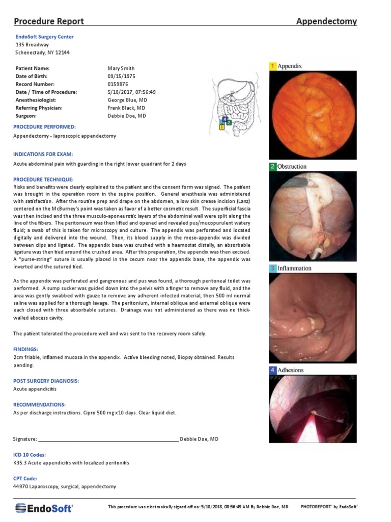 Laparoscopic Appendectomy Procedure Report for Mary Smith Describing