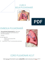 Embolia Pulmonara PDF