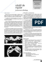 Acúfeno Pulsátil de Etiología Singular: Pulsatil Tinnitus of Uncommon Ethiology