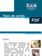 caries-120506131100-phpapp01.pdf