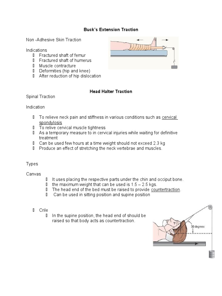 NonInvasive Traction Techniques Buck's Extension, Head Halter, and