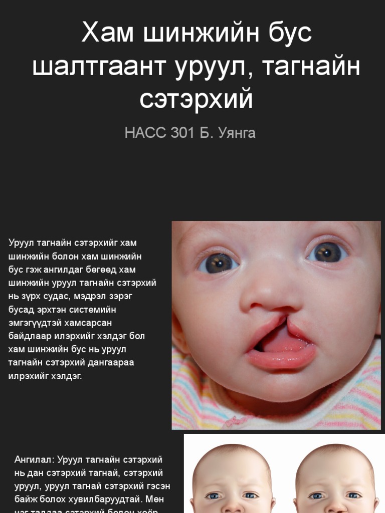 Хам шинжийн бус шалтгаант уруул, тагнайн сэтэрхий | PDF
