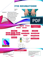 Artritis Reumatoide