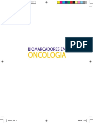 Onconews - Ooforectomia profilática em BRCA1