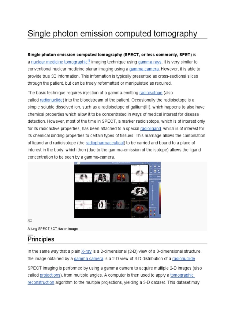 Single Photon Emission Computed Tomography | PDF | Positron Emission ...