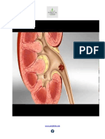Ayurvedic Treatment For Kidney Stone Nag PDF