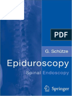 Günter Schütze - Epiduroscopy - Spinal Endoscopy (2009, Springer) PDF