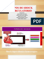 Tipos de Shock Circulatorio