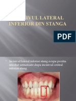 Incisivul Lateral Inferior Din Stanga