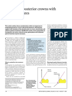 Integrating Posterior Crowns With Partial Dentures: Restorative Dentistry