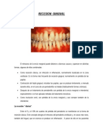 RECESIÓN  GINGIVAL