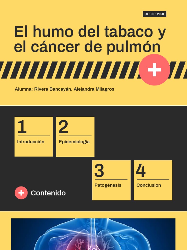 El humo del tabaco como principal factor de riesgo del cáncer de pulmón ...