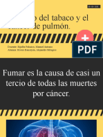Cancer de Pulmon - Exposición
