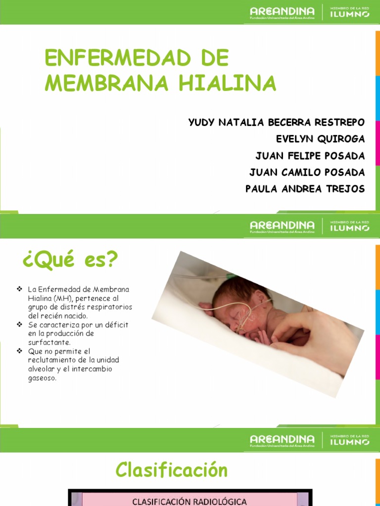 Enfermedad de Membrana Hialina PDF Pulmón Sistema respiratorio
