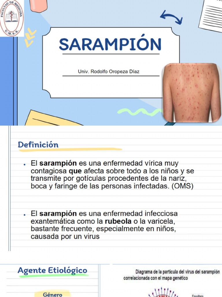 Sarampion Pdf