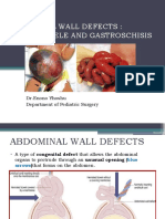 Abdominal Wall Defects: Omphalocele and Gastroschisis: DR - Enono Yhoshu Department of Pediatric Surgery
