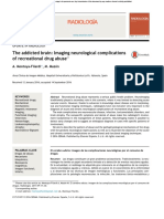 The Addicted Brain: Imaging Neurological Complications of Recreational Drug Abuse