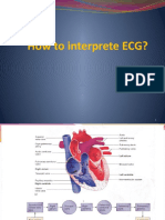 Interpretase Ekg Ali Haedar