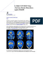 People With Mild COVID19 May Experience Serious Brain Disorders