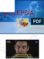 Epilepsia