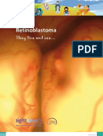 Retinoblastoma