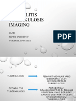 Spondilitis TB Imaging