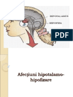 Afectiuni Hipotal-Hipofizar