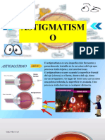 Anatomía Astigmatismo