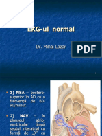 LP 1 - EKG normal