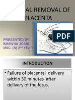 Mannual Removal of Placenta: Presented By-Bhawna Joshi MSC. (N) 2 Year