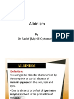 Albinism: by DR Sadaf (Mphill Optometry)