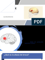 Afasia de Broca Diapositivas