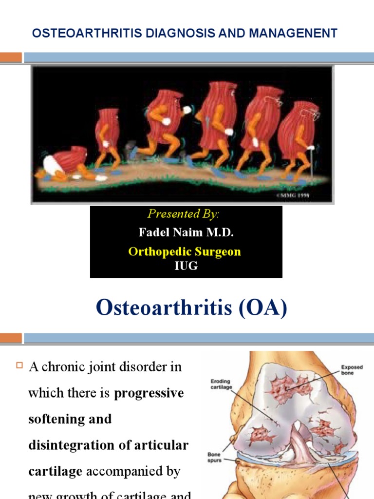 Osteoarthritis Diagnosis and Management | PDF | Osteoarthritis | Arthritis