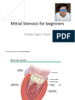 Mitral Stenosis For Beginners: Pratap Sagar Tiwari