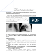 2009_cc4_masa_pulmonar_cavitada.doc