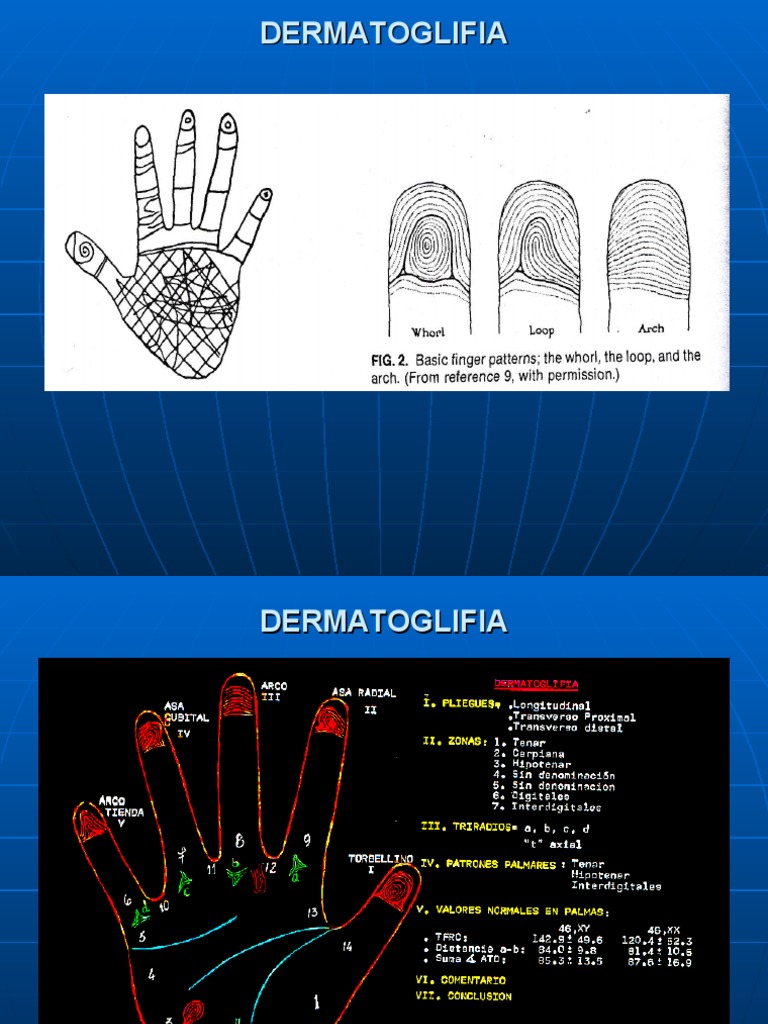 DERMATOGLIFIA | PDF