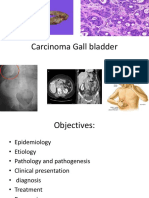 Gallbladder Cancer Treatment and Prognosis