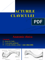 Fracturile Claviculei