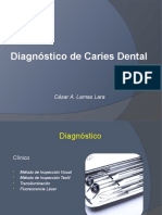Diagnóstico de Caries Dental: Métodos Clínicos y Radiográficos para su Detección