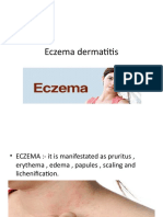 Eczema dermatitis