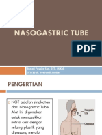 Nasogastric Tube (NGT) PDF