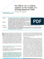 Effect Implant Cochlear Printed