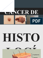 Cancer de Piel