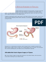 Mini Gastric Bypass Surgery in Tijuana PDF