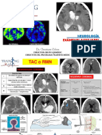 2. EXÁMENES AUXILIARES - NEUROLOGÍA.pdf