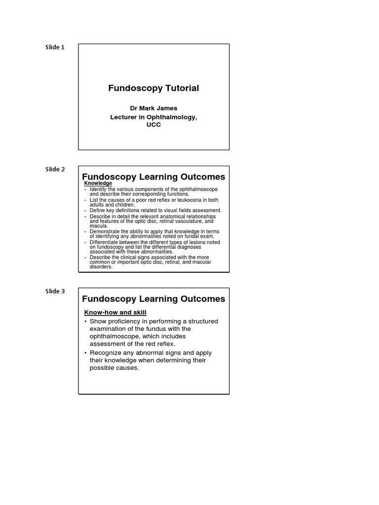 Fundoscopy Tutorial: Slide 1 | PDF | Retina | Cornea