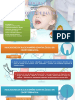 Diapositivas. RX en Odontopediatria